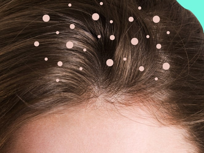 woman's scalp hair. best oil for hair growth